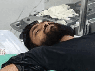 Worker injured after being hit by press machine