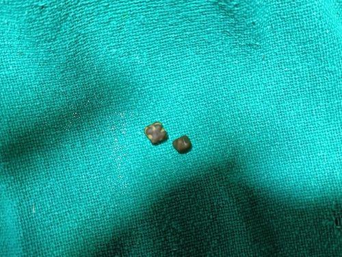Urinary bladder surgery in dogs successfully performed by veterinarians
