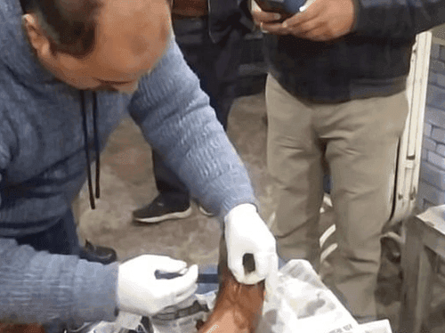 Police gave first aid to the injured woman